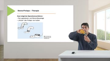 Stoma: Komplikationen